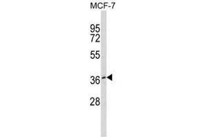 Western blot analysis of BMI1 Antibody in MDA-MB231 cell line lysates (35ug/lane). (BMI1 Antikörper)