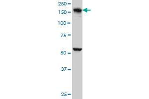 EEA1 monoclonal antibody (M02A), clone 1D4 Western Blot analysis of EEA1 expression in A-431 .