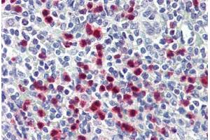 Human Spleen (formalin-fixed, paraffin-embedded) stained with S100A8 antibody ABIN364230 at 1:50 followed by biotinylated anti-mouse IgG secondary antibody ABIN481714, alkaline phosphatase-streptavidin and chromogen. (S100A8 Antikörper  (FITC))