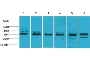 Western Blot (WB) analysis of 1) HeLa, 2) 293T, 3) C2C12, 4) Mouse Liver Tissue, 5) PC12, 6) Rat Brain Tissue with TBP Rabbit Polyclonal Antibody diluted at 1:2000. (TBP Antikörper)