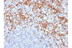 Immunohistochemistry (IHC) image for anti-Matrix Metallopeptidase 9 (Gelatinase B, 92kDa Gelatinase, 92kDa Type IV Collagenase) (MMP9) (AA 22-166) antibody (ABIN6940076)