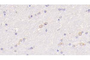 Detection of WNT5A in Mouse Cerebrum Tissue using Polyclonal Antibody to Wingless Type MMTV Integration Site Family, Member 5A (WNT5A) (WNT5A Antikörper  (AA 62-380))