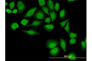 Immunofluorescence of monoclonal antibody to TXN on HeLa cell. (TXN Antikörper  (AA 1-105))