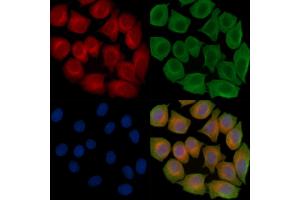 ABIN6262772 and ABIN6267008 staining Hela cells(45 min of heat-shock treatment) by IF/ICC. (KRT15 Antikörper  (N-Term))