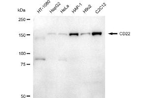 Western blotting analysis using CD22 antibody (ABIN7797958). (Rekombinanter CD22 Antikörper)