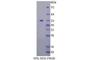 SDS-PAGE analysis of Human TAT Protein. (TAT Protein)