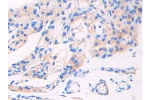 Used in DAB staining on fromalin fixed paraffin- embedded pancreas tissue (GAD Antikörper  (AA 1-97))