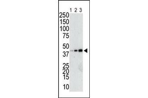 The anti-GST Pab (ABIN388090 and ABIN2843198) is used in Western blot to detect a GST-fusion recombinant protein (42 kDa) purified from bacterial lysate (Lanes 1-3: 10, 40, and 160 ng GST-fusion protein). (GST-Tag Antikörper)