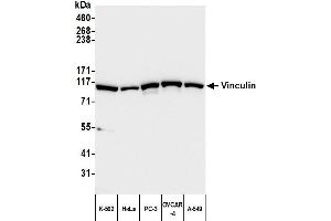 Western Blotting (WB) image for anti-Vinculin (VCL) (AA 1016-1066) antibody (ABIN7454836)
