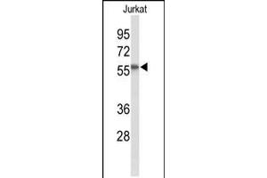 Western blot analysis of SACM1L Antibody in Jurkat cell line lysates (35ug/lane) (SACM1L Antikörper  (C-Term))
