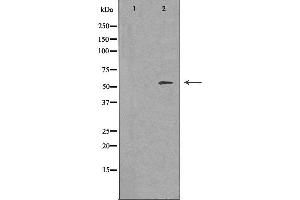 Western blot analysis of extracts from Jurkat cells, using FRK antibody. (FRK Antikörper  (Internal Region))