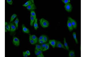 Immunofluorescence staining of HepG2 cells with ABIN7149663 at 1:66, counter-stained with DAPI. (Transmembrane 7 Superfamily Member 4 (TM7SF4) (AA 119-209) Antikörper)