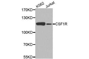 Western blot analysis of extracts of various cell lines, using CSF1R antibody. (CSF1R Antikörper)
