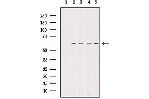 Western blot analysis of extracts from various samples, using TIGD2 Antibody. (TIGD2 Antikörper)