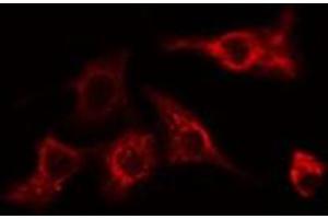 ABIN6275089 staining HeLa cells by IF/ICC. (MYLIP Antikörper  (Internal Region))