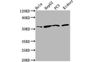 Western Blot Positive WB detected in: Hela whole cell lysate, HepG2 whole cell lysate, PC-3 whole cell lysate, Rat kidney tissue All lanes: TTI2 antibody at 8. (TTI2 Antikörper  (AA 159-264))