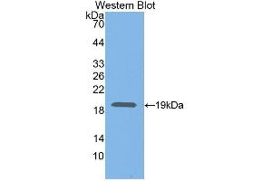 Western blot analysis of the recombinant protein. (Neuregulin 1 Antikörper  (AA 328-486))