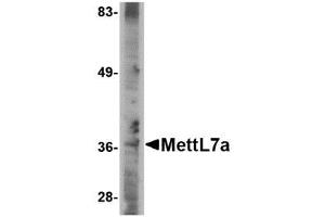 Image no. 1 for anti-Methyltransferase Like 7A (METTL7A) (C-Term) antibody (ABIN341690) (METTL7A Antikörper  (C-Term))