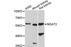 Western blot analysis of extracts of various cell lines, using MGAT2 antibody. (MGAT2 Antikörper)