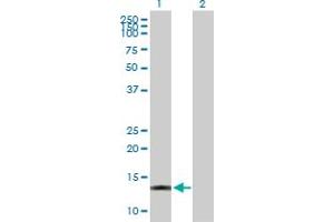 Western Blot analysis of ACOT13 expression in transfected 293T cell line by ACOT13 MaxPab polyclonal antibody. (THEM2 Antikörper  (AA 1-140))