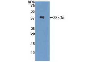 Detection of Recombinant SPINK1, Human using Polyclonal Antibody to Serine Peptidase Inhibitor Kazal Type 1 (SPINK1) (SPINK1 Antikörper  (AA 26-78))