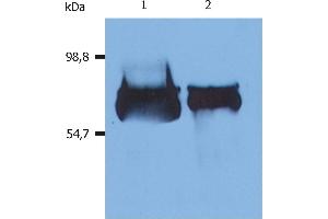 Western Blotting analysis (reducing conditions) of human serum albumin using anti-human Albumin (AL-01). (Albumin Antikörper)