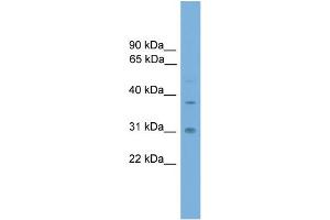 WB Suggested Anti-AIP Antibody Titration: 0. (AIP Antikörper  (Middle Region))