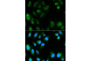 Immunofluorescence analysis of MCF7 cell using UCP3 antibody. (UCP3 Antikörper)