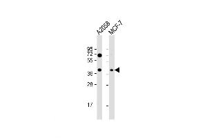 Western Blot at 1:1000 dilution Lane 1: A2058 whole cell lysate Lane 2: MCF-7 whole cell lysate Lysates/proteins at 20 ug per lane.