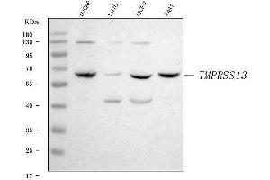 Western blot analysis of TMPRSS13 using anti-TMPRSS13 antibody (ABIN7599797). (TMPRSS13 Antikörper  (AA 118-572))