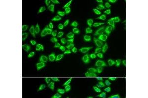 Immunofluorescence analysis of A549 cells using HADHB Polyclonal Antibody (HADHB Antikörper)