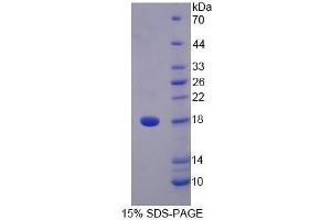 SDS-PAGE (SDS) image for Signal Transducer and Activator of Transcription 5A (STAT5A) (AA 673-773) protein (His tag) (ABIN1171372) (STAT5A Protein (AA 673-773) (His tag))