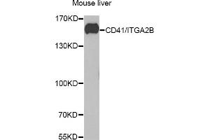 Western blot analysis of extracts of mouse liver, using CD41/CD41/ITGB antibody (ABIN6129287, ABIN6142560, ABIN6142562 and ABIN6221333) at 1:1000 dilution. (Integrin Alpha2b Antikörper  (AA 693-993))
