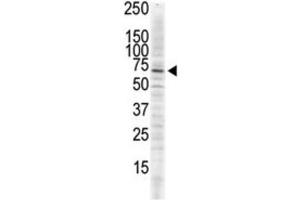 Western Blotting (WB) image for anti-Calcium/calmodulin-Dependent Protein Kinase II delta (CAMK2D) antibody (ABIN5023065) (CAMK2D Antikörper)