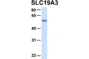 Western Blotting (WB) image for anti-Solute Carrier Family 19, Member 3 (Slc19a3) (Middle Region) antibody (ABIN2775519)