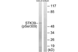 Western blot analysis of extracts from COLO cells using STK39 (Phospho-Ser309) Antibody. (STK39 Antikörper  (pSer311))
