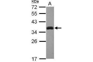 WB Image Sample (30 ug of whole cell lysate) A: HepG2 12% SDS PAGE antibody diluted at 1:1000 (SULT1A3 Antikörper  (Center))