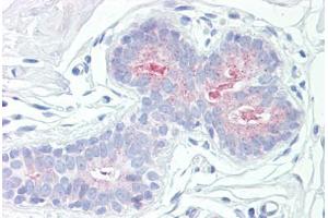 Anti-RPS6KB1 / S6K antibody IHC staining of human breast.
