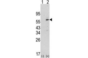 Western blot analysis of PDK1 antibody and 293 cell lysate (2 ug/lane) either nontransfected (Lane 1) or transiently transfected with the PDK1 gene (2).