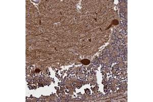 Immunohistochemical staining of human cerebellum with PLP2 polyclonal antibody  shows strong cytoplasmic positivity in purkinje cells at 1:50-1:200 dilution. (PLP2 Antikörper)