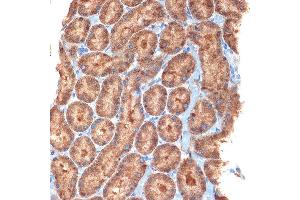 Immunohistochemistry of paraffin-embedded rat kidney using NEK6 Rabbit mAb (ABIN7268916) at dilution of 1:100 (40x lens). (NEK6 Antikörper)