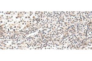 Immunohistochemistry of paraffin-embedded Human tonsil tissue using CKMT1A/CKMT1B Polyclonal Antibody at dilution of 1:55(x200) (CKMT1 Antikörper)