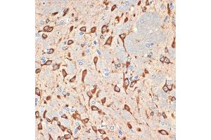 Immunohistochemistry of paraffin-embedded rat brain using Musashi-2 (Musashi-2 (MSI2)) Rabbit mAb (ABIN7268701) at dilution of 1:100 (40x lens). (MSI2 Antikörper)