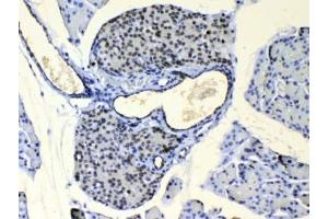 IHC testing of FFPE mouse pancreas tissue with COPE antibody at 1ug/ml. (COPE Antikörper)