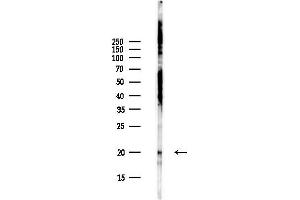 Western blot analysis of lysates from Hela cells(UV,30 min treatment), using VKORC1L1 Antibody at 1/1000 dilution.