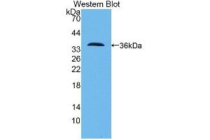 Detection of Recombinant PCNT, Human using Polyclonal Antibody to Pericentrin (PCNT) (PCNT Antikörper  (AA 2987-3246))