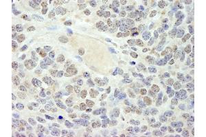 Immunohistochemistry (IHC) image for anti-High Mobility Group Box 3 (HMGB3) (AA 125-175) antibody (ABIN7448596) (HMGB3 Antikörper  (AA 125-175))