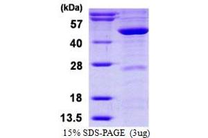 SDS-PAGE (SDS) image for Mevalonate (Diphospho) Decarboxylase (MVD) (AA 1-400) protein (His tag) (ABIN668000)