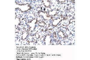 Human Lung (Endoglin Antikörper  (N-Term))