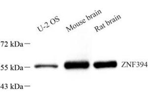 Western blot analysis of ZNF394 (ABIN7076266) at dilution of 1: 1500 (ZNF394 Antikörper)